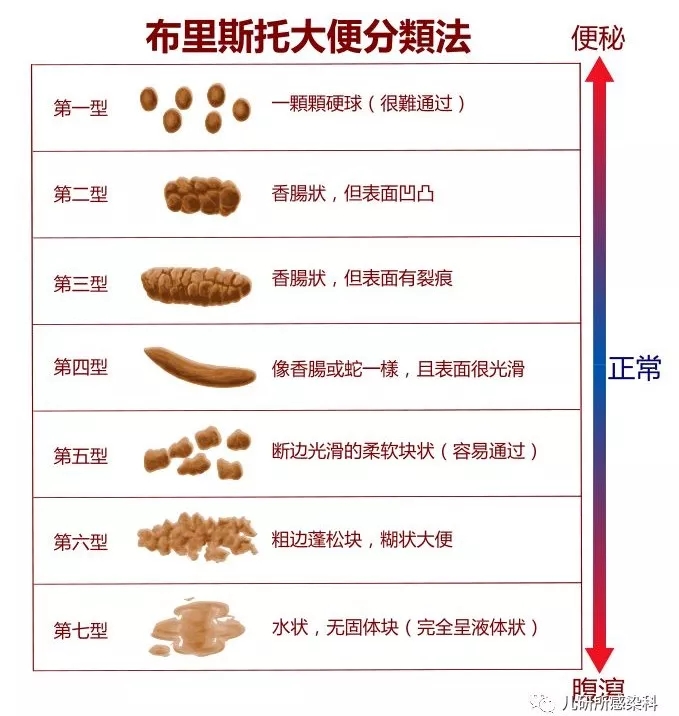 典型临床表现 流行季节发病可作出初步判断,大便做快速轮状病毒检测可